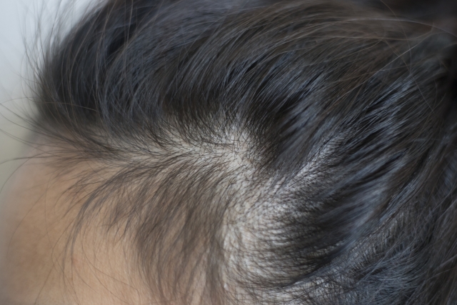 髪の毛のトラブルの原因と４０代からのヘアケアの方法